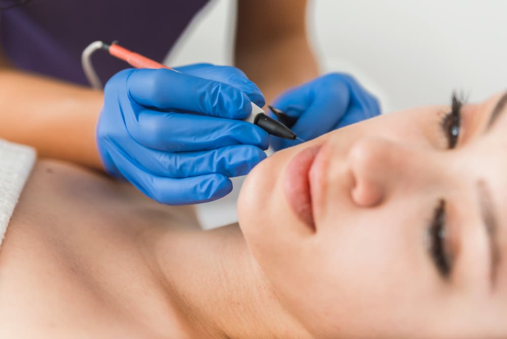 Confident woman after 15-minute underarm epilation at The Beauty Spot in Wadebridge